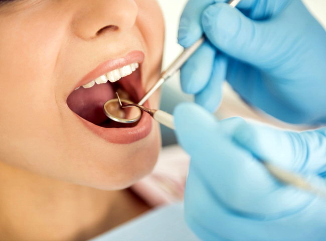 dental-veneer-Deepcar
