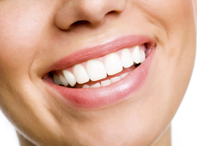 teeth-whitening-Deepcar